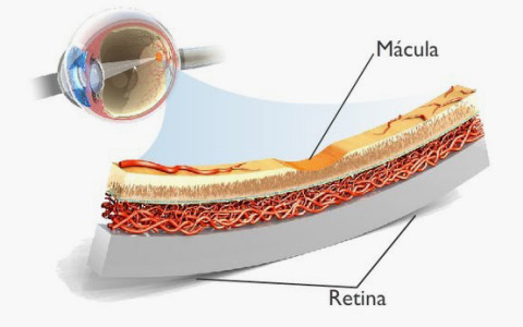 macula 480x300 1